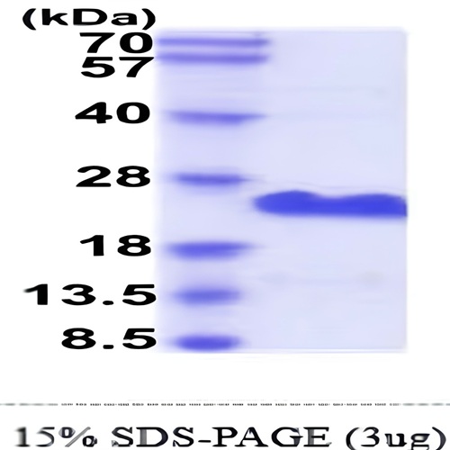 CD20 Protein Human Recombinant Antibody 1